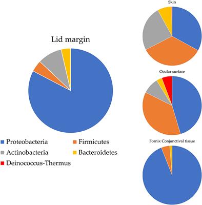 Ocular surface microbiota: Ophthalmic infectious disease and probiotics